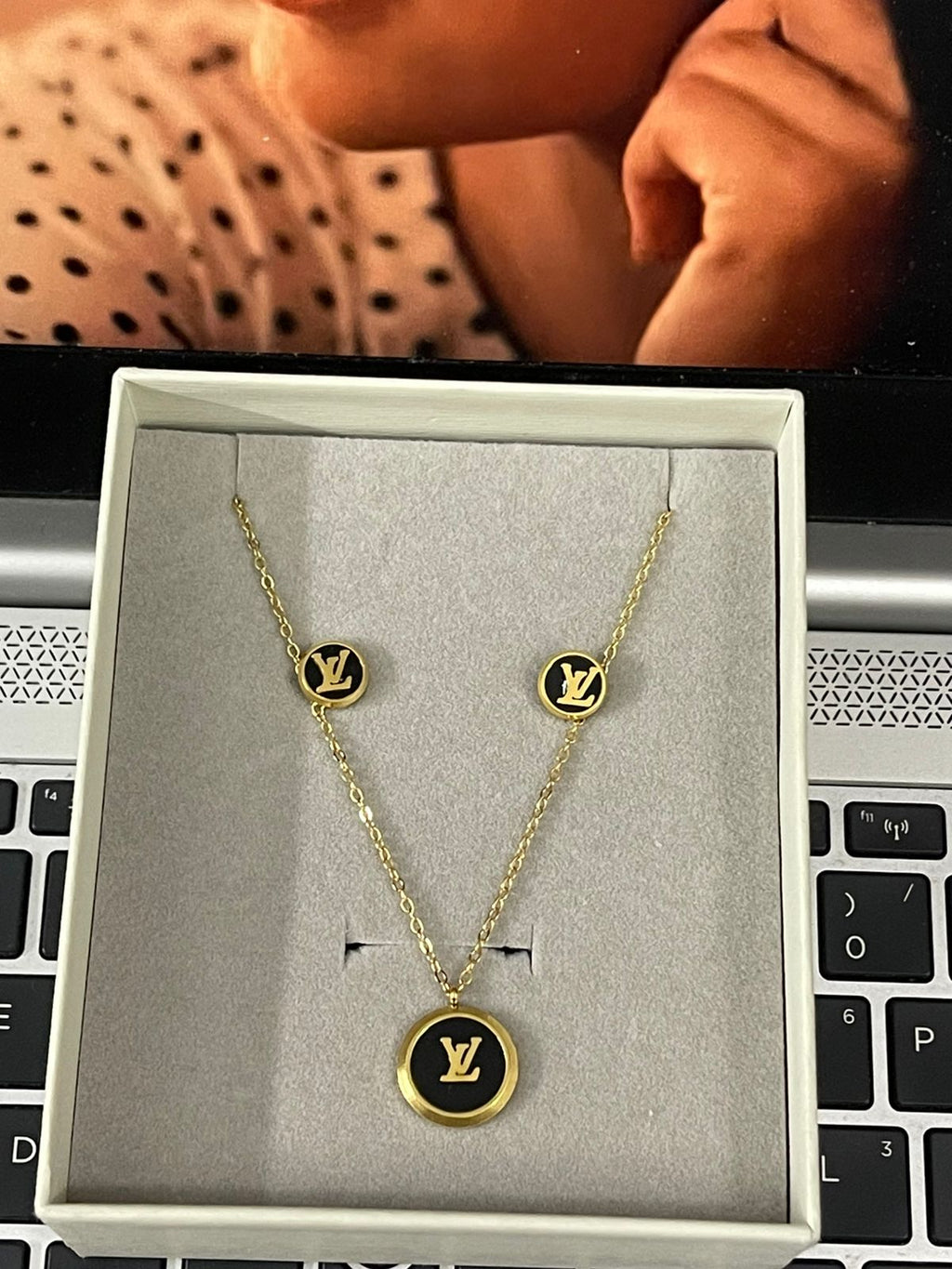 Noir Medallion Set